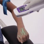 Accuvein Viewer